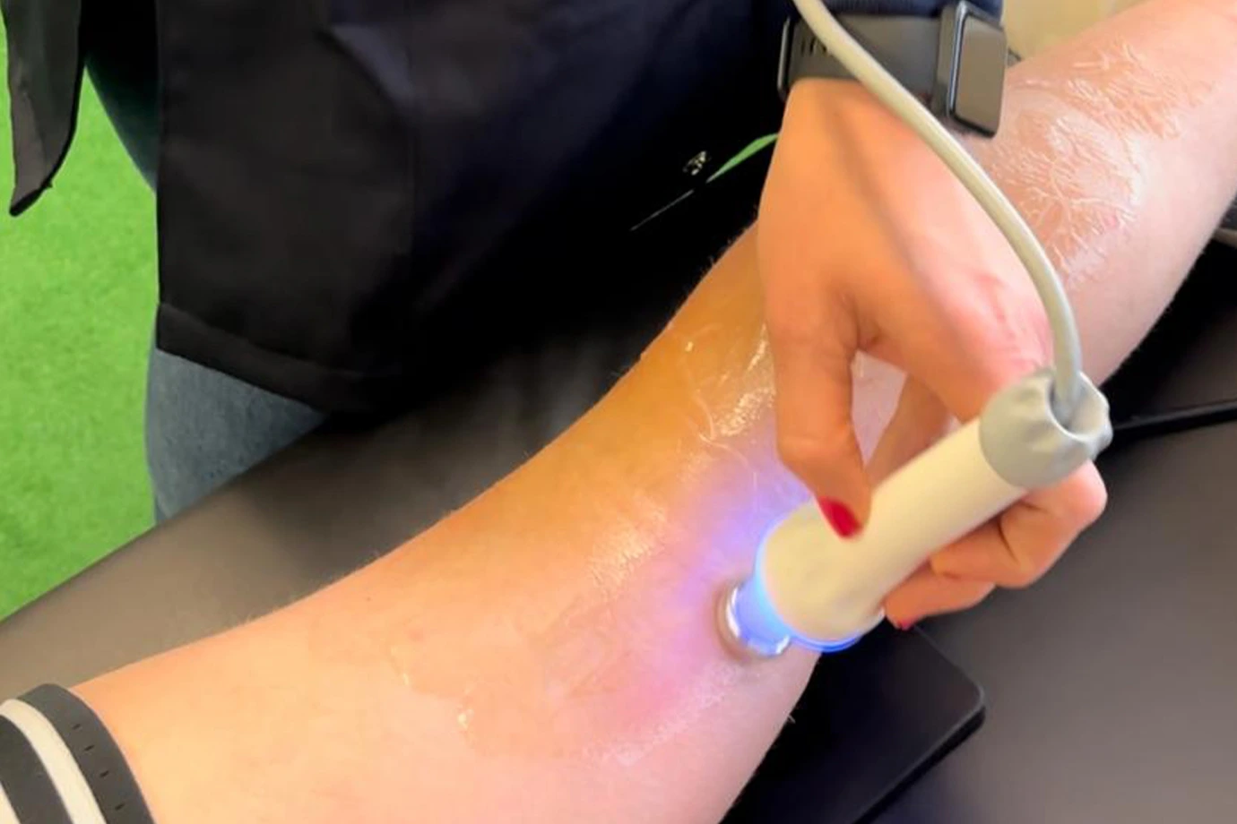laser gel_4